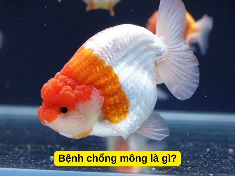 Bệnh chổng mông là gì?